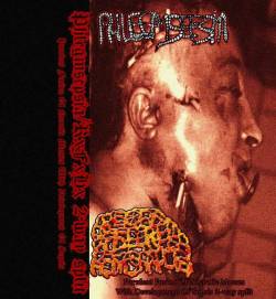 Phlegmsepsia : Purulent Fusion of Necrotic Masses with Development of Sepsis